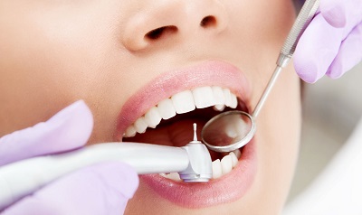 Лечение зубов без